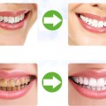 Bột trắng răng than tre Teeth Whitening J124